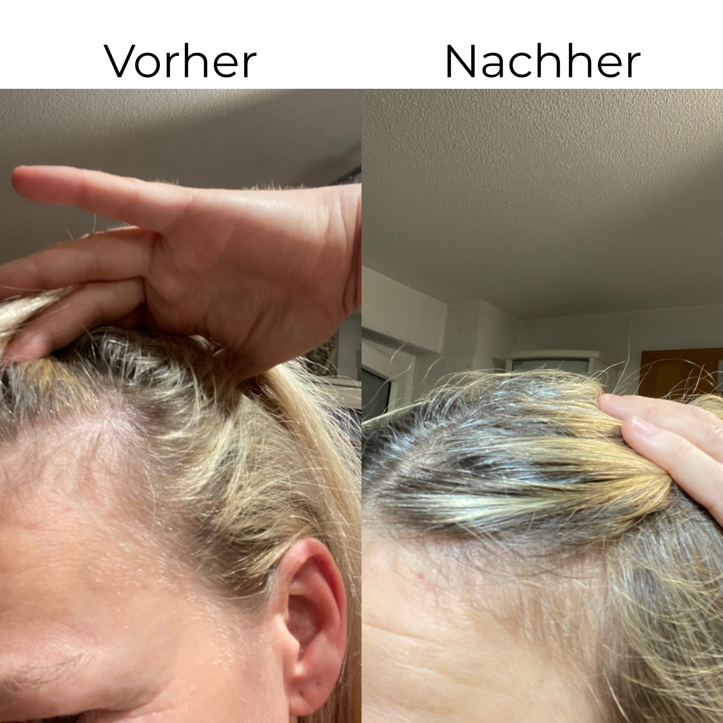 Haarkräftigungs-Set